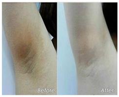 שמן ויטמין C מרוכז מאוד להלבנת העור