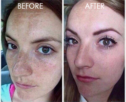 שמן ויטמין C מרוכז מאוד להלבנת העור