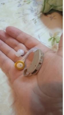 חוות דעת - מכשיר שמיעה מתקדם ללקויות שמיעה שונות