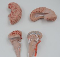 בהזמנה מראש: דגם אנטומי 611 - מוח אנושי בגודל מלא, 9 חלקים