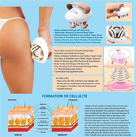 מכשיר עיסוי שרירים