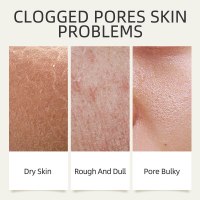 מסכת פנים תה ירוק לניקוי עמוק- Deeptea.G