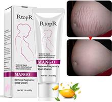 צלוליטיס - קרם לסימני מתיחה וצלוליטיס