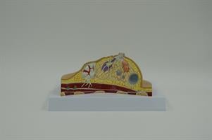 דגם אנטומי 0741 - שד עם פתולוגיות נפוצות