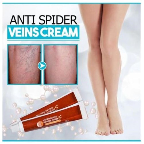 קרם שיקומי לטיפול בדליות-VEINS CREAM