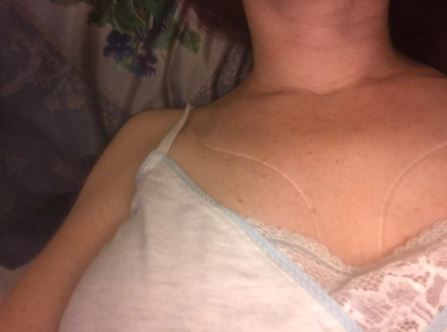 חוות דעת - ערכת מדבקות טיפול בוטוקס להידוק ומיצוק הפנים, הצוואר והדקולטה