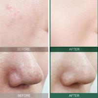 טונר הפלא - 30 יום לשלמות העור