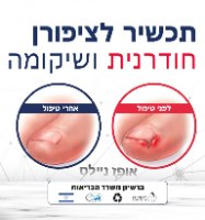 תכשיר לציפורן חודרנית ושיקומה 30 מ"ל PEDIPRO