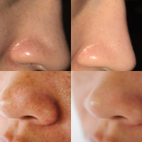 סרום פני חרסינה