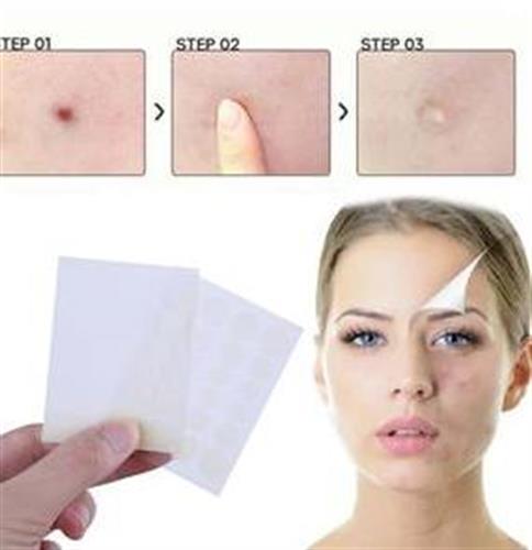 מדבקות הפלא להעלמת פצעים, שומות וצלקות - 36 יח'