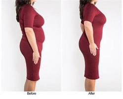 מעצב גוף אלסטי