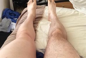 ספריי אפילציה להסרת שיער לצמיתות