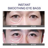 סרום טיפולי לעיניים- therapEYEserum