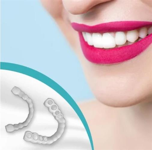 כיסוי שיניים קוסמטי להתאמה אישית - Fit Flex