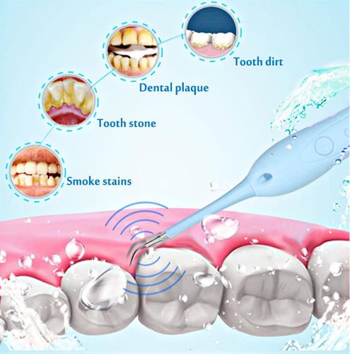 ידית רופא דנטלית לניקוי אבנית, כתמי קפה וצהוב בשניים ללא חשש לפגיעה בשן