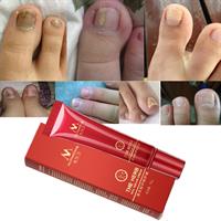 המשחה הסינית לפטרת הציפורן - Herbal