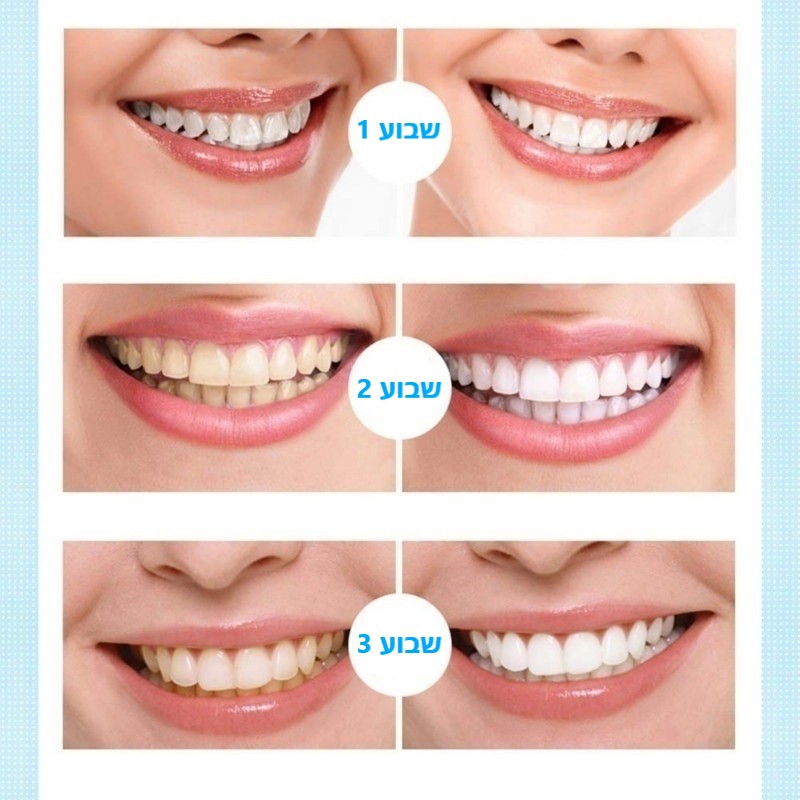 תהליך הלבנת השיניים תוך 3 שבועות