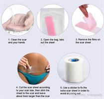 רצועת ג'ל אורגנית להעלמת צלקות -  Kinsmirat gel