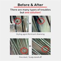 מברשת שיער למניעה וטיפול בקשקשים