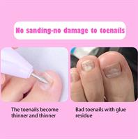 ​מדבקות ריפוי לציפורן חודרנית- HealignailS.K