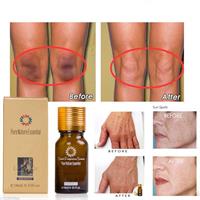 שמן להורדת כתמי פיגמנטציה בפנים ובעור - Pure Nature