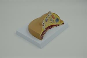 דגם אנטומי 0741 - שד עם פתולוגיות נפוצות