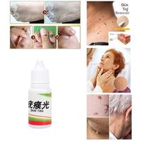 תכשיר  להסרת שומות  - SKIN TAG