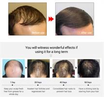 PURC -סרום לעידוד צמיחת השיער