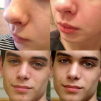 סרום פני חרסינה