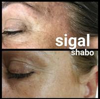 לייט קרם ביופור