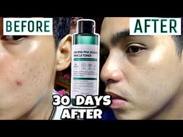 טונר הפלא - 30 יום לשלמות העור