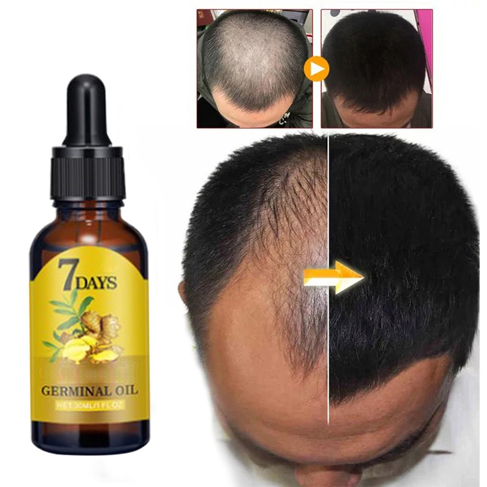 buy-mielle-s-rosemary-mint-scalp-hair-strengthening-oil-with-biotin