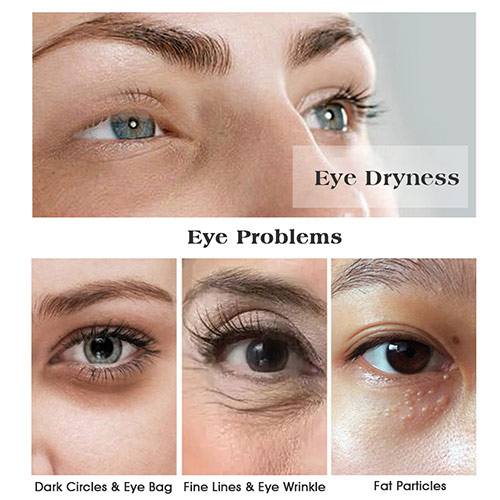 collagen eye wrinkle