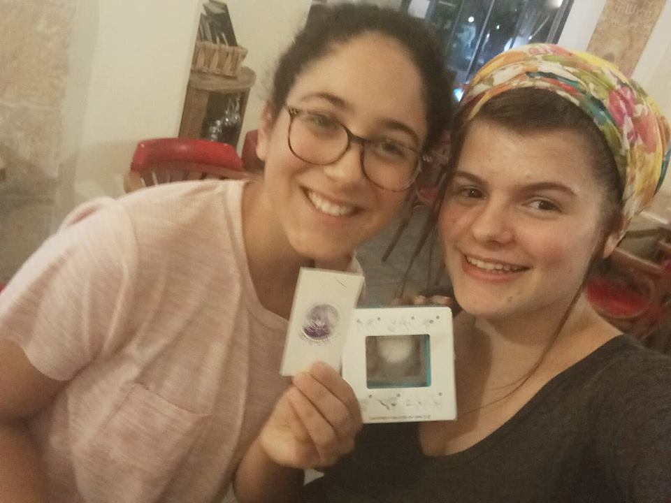 חוות דעת - גביעונית לונט lunette