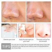 סרום לילה מובחר להורדת שחורים בפנים - סקיור