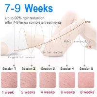 מכשיר IPL ביתי להסרת שיער לצמיתות - ללא כאב