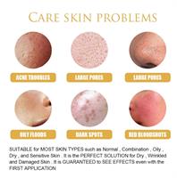 ביצת הזהב - מסכת שמרים אנטי אייג'ינג-  A.agingYeast