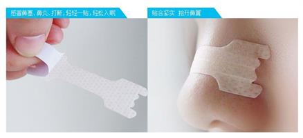 מדבקות לאף נגד נחירות