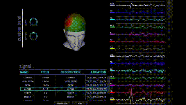 EEG-אגג-נוירואקטיב-אי.אי.גי 